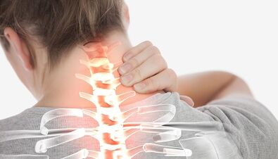 How to treat the osteochondrosis of the cervical column