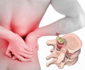 Lumbago at the beginning of the osteochondrosis of the disease