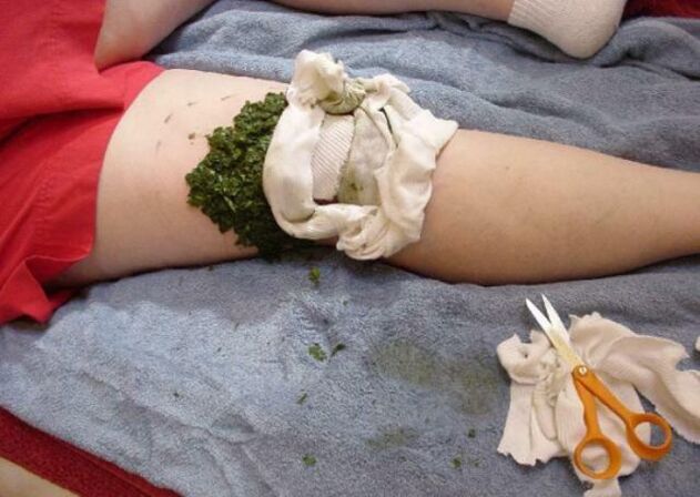 compress for osteoarthritis of the knee joint.
