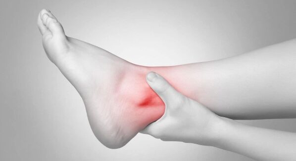 Joint stiffness and chronic ankle pain are complications of cruarthrosis